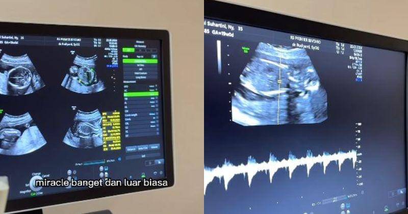 Instagram.com/vicymelanie